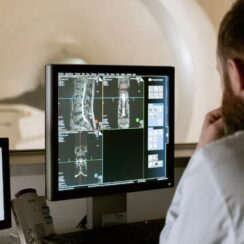 Osteoporoz Nedir? Belirtileri Nelerdir? Nasıl Tedavi Edilir?