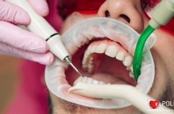 Diş Temizletme Yapılmalı mı?