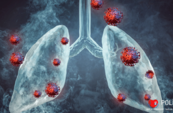 Akciğer Kanseri Nedir?