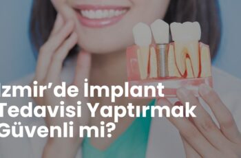 İzmir’de İmplant Tedavisi Yaptırmak Güvenli mi? 2