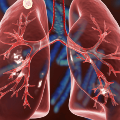 Akciğer Sağlığı İçin Dikkat Edilmesi Gerekenler