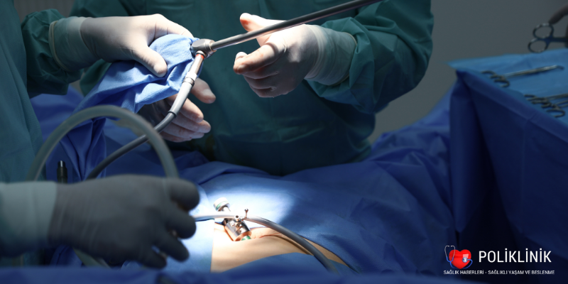Laparoskopik Ameliyat Nedir? Avantajları ve Dezavantajları 1